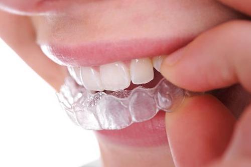 Best retainers and splinting treatment