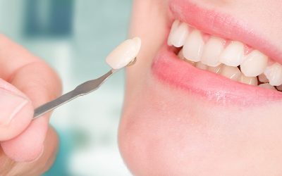What to Expect During Your First Visit to Dr. Rupali’s Dental Clinic