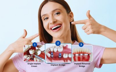 How Fluoride Treatment Prevents Cavities and Strengthens Teeth